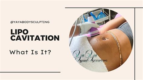 Lipo Cavitation: Treatment & Sessions Explained .